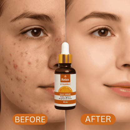 Relax UK Vitamin C Face Serum 30ml